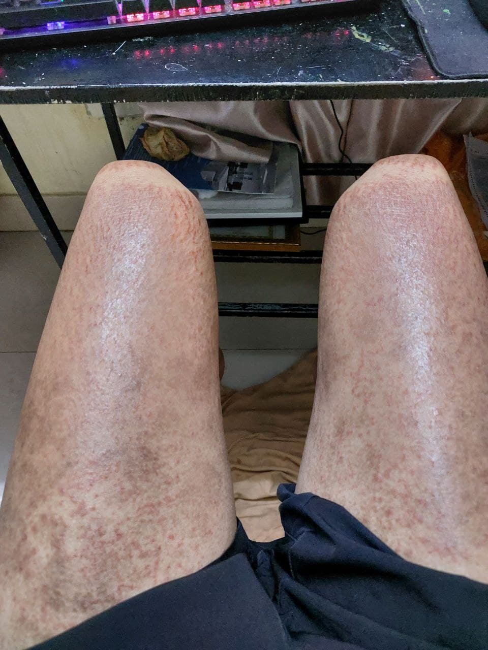 Co the - Truoc dieu tri